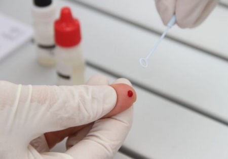 Prefeitura realiza ação de testagem rápida de AIDS