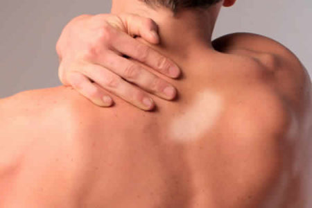 Profissionais da saúde participam de formação sobre Hanseníase