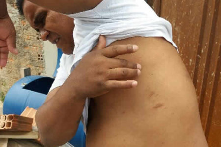 Homem é picado por escorpião ao deitar para dormir em Hortolândia
