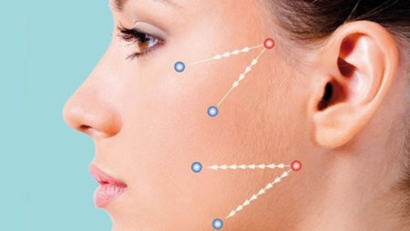 Suspensão com fios: saiba mais sobre a técnica que elimina rugas e flacidez sem cirurgia