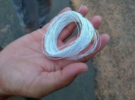 Criança tem pescoço cortado por linha de pipa com cerol no Santa Clara do Lago
