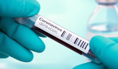 Brasil ultrapassa marca de 10 mil casos de coronavírus e mais de 430 mortes