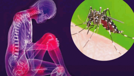 Vacina contra chikungunya desenvolvida por parceira do Butantan tem 98,5% de eficácia