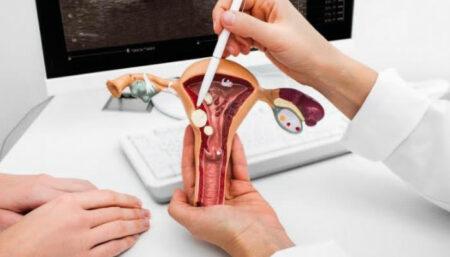 <strong>Miomas uterinos</strong>