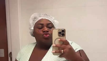 Cantora Jojo Todynho realiza cirurgia bariátrica e compartilha humorado vídeo pós-operatório