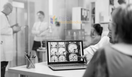 Ribeirão Preto é vanguarda em Acidente Vascular Cerebral