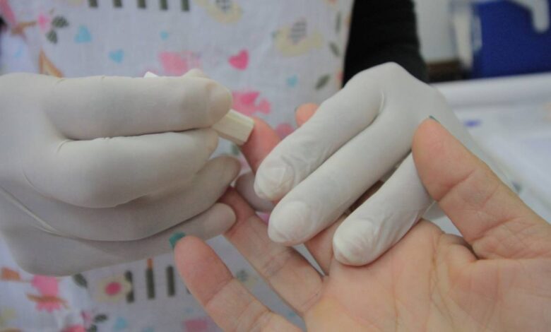Hepatites Virais