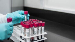 Campinas tem 50 vagas em curso gratuito para quem quer trabalhar na área da saúde coletando sangue 