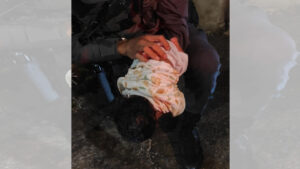 Bebê é salvo pela PM após parada respiratória, em Hortolândia