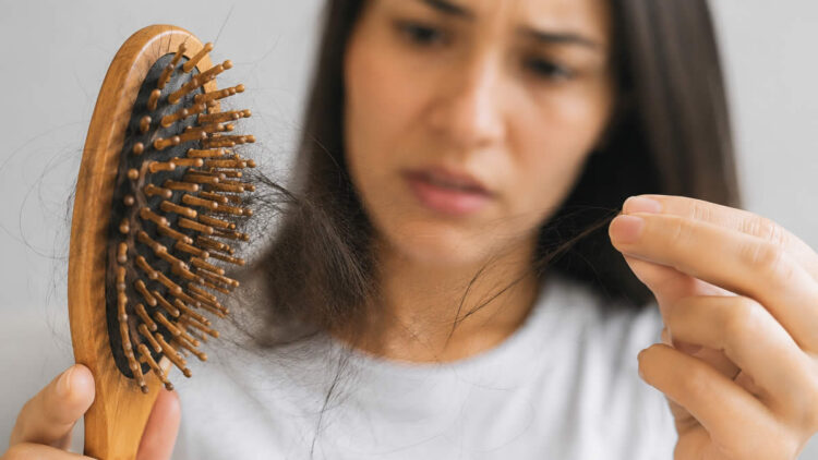 Queda de cabelo