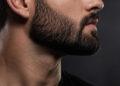 Falhas na barba
