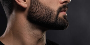 Falhas na barba