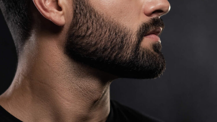 Falhas na barba