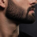 Falhas na barba