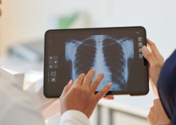 hipertensão pulmonar