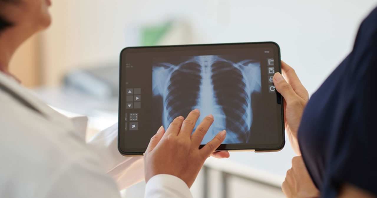 hipertensão pulmonar