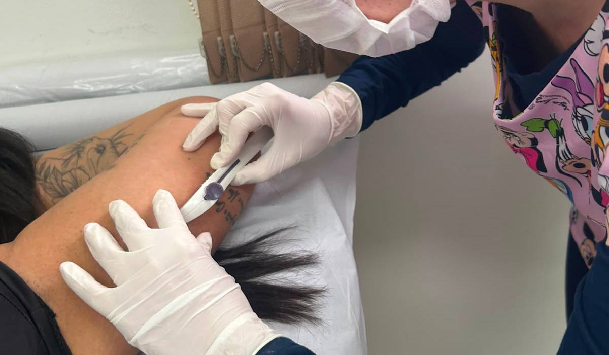 métodos contraceptivos