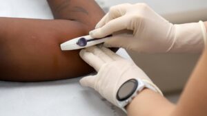 Adesão ao implante anticoncepcional cresce 553% em Campinas