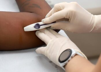 Implante anticoncepcional método contraceptivo de longa duração