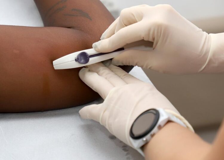Implante anticoncepcional método contraceptivo de longa duração